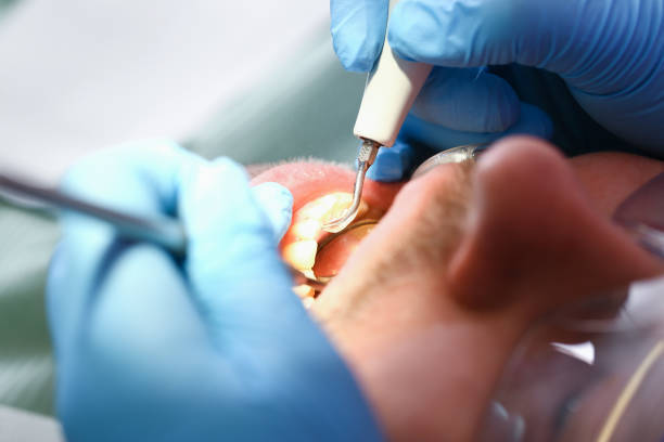 Best Urgent Tooth Repair  in Homeland, GA