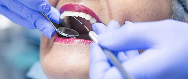 Best Chipped Tooth Repair Near Me  in Homeland, GA